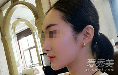 宋小宝朋友爆料视频,揭秘背后惊人真相！  第2张